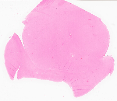 ['deident_f21e6b20-f559-48fc-8997-fd362096b461_69d95891.jpg']