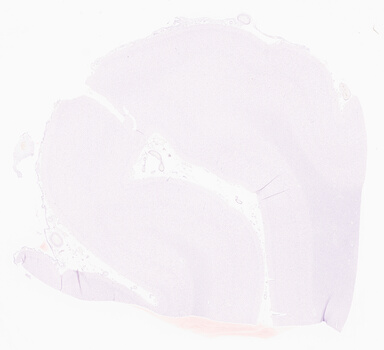 ['deident_ce68a4cc-b477-4570-99c4-cfb88eead50e_69d95885.jpg']