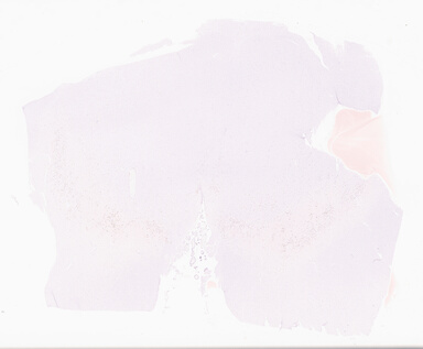 ['deident_b797ae60-1bd2-4bac-8b8d-7cdcd8c03ed3_69d9587c.jpg']