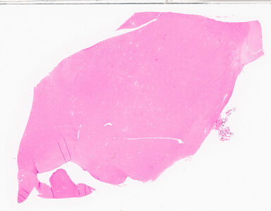 ['deident_8b5bc236-d53f-440f-9054-c84d0ce56e4c_69d95866.jpg']