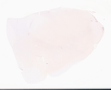 ['deident_1d94dab9-4fea-4068-be9a-f7cfd3e48519_69d95828.jpg']