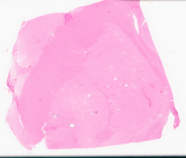 ['deident_20da6c60-cbde-44ff-83b6-000dd9dede31_69d9582d.jpg']