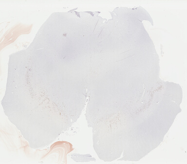 ['deident_4383abfc-71e1-48da-87de-294ea0706df2_69b0493a.jpg']