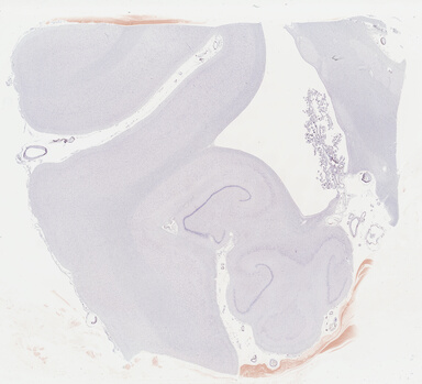 ['deident_0817e8af-4a8e-44ab-9c8d-bf168bdce19d_69b0492a.jpg']