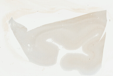 ['deident_59cdb978-ac03-416c-8a5d-7afb1b130396_69b04941.jpg']