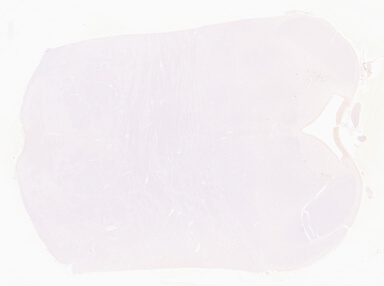 ['deident_968eecbd-50a1-4974-8f55-b7b444ec65b7_69b0494b.jpg']