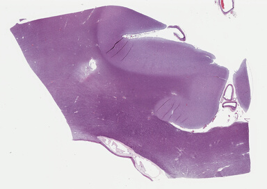 ['deident_47f70562-ddfd-4054-b015-0617ad049c39_69b0493e.jpg']