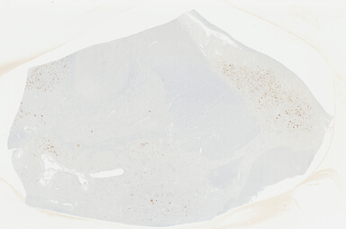 ['deident_6209bea9-711c-4761-bd21-a97c81685e8d_69b04942.jpg']