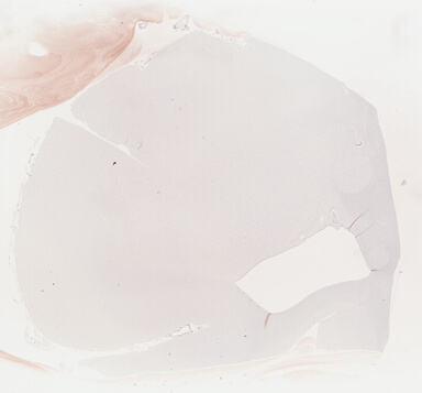 ['deident_00a678e1-9b56-4153-8d30-a66a150bb906_69b04925.jpg']