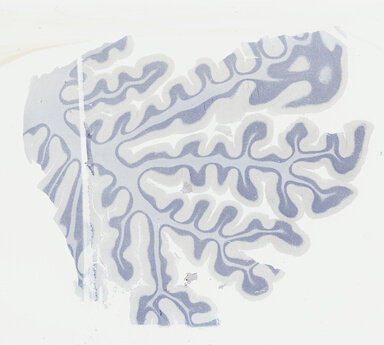['deident_4f6880b5-ad42-455c-aaa8-7f945ee2ca33_69b0493f.jpg']