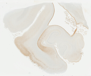 ['deident_da16459d-91ef-41f6-bf5c-8c73c3875377_69b04958.jpg']