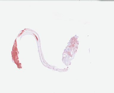 ['deident_1f65452d-334d-43f2-895d-471519fd93df.jpg']