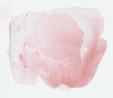 ['deident_1fd905f0-6fc6-430b-8f20-00c8ff7df6e8.jpg']
