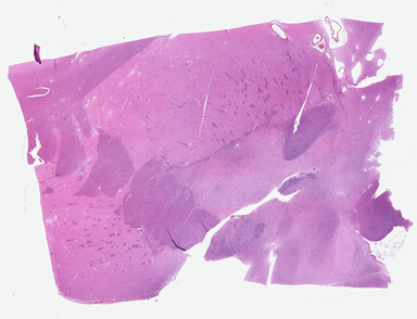 ['deident_233ddc51-b705-4eb7-ba3f-712f5afab6dd.jpg']
