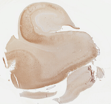 ['deident_4c5ba5f8-1f50-4afb-8e62-6cf69ed52af8.jpg']