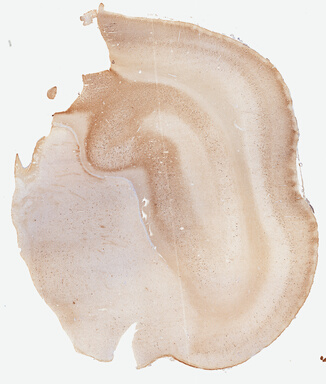 ['deident_eba7826d-2e60-4abc-b7bb-3fa69bf1b38e.jpg']
