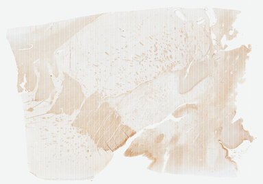 ['deident_bd9df133-1866-448b-8bee-26bed0ee13a1.jpg']
