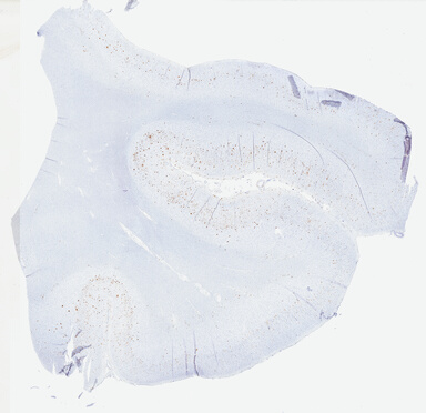 ['deident_1ab739df-1163-4f02-bad1-9aec25dd82e0.jpg']