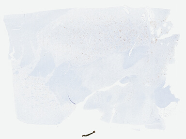 ['deident_e6f6d99b-1a06-437a-851b-885d99e21ad2.jpg']