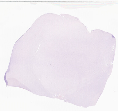['deident_e0943825-d61c-49c1-8a2f-dd3ee3f19d61.jpg']
