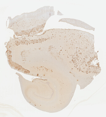 ['deident_41c83b76-2f57-4ae2-9fd5-e8e0284f50e7.jpg']