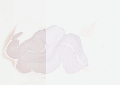 ['deident_531f05dc-ae96-416b-9d23-3c73bf056c9c.jpg']