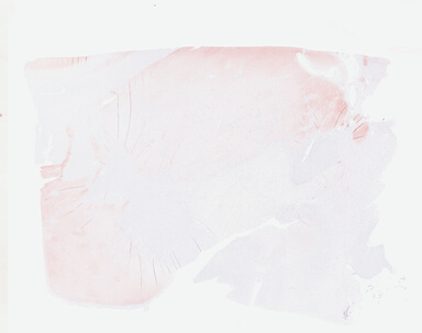 ['deident_95046f2f-7aa7-41b1-bc79-ac9c3b688111.jpg']