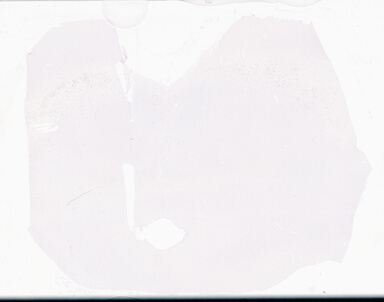 ['deident_ad7d92f1-25b8-48bf-86de-08c6848e95da_69d94fde.jpg']
