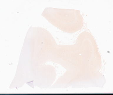 ['deident_95d79809-c41c-4158-a436-1132a9dd2146_69d94fd5.jpg']