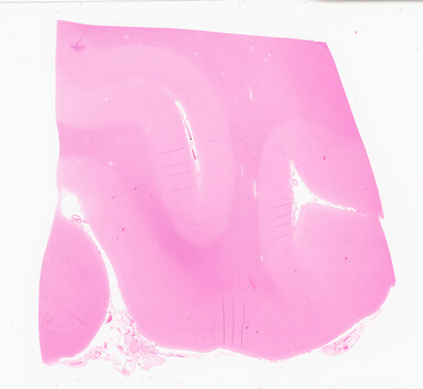 ['deident_5a0c6bc6-7577-4847-8204-bffac75ab91d_69d94fac.jpg']