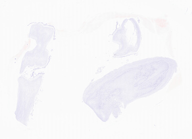 ['deident_17313d79-5d89-4b73-9bb3-35f958b34cb1_69d94f8f.jpg']