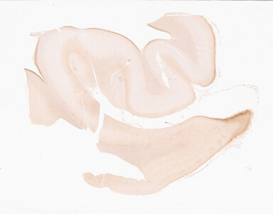 ['deident_799024e9-00b7-4bfd-9fdb-e1bf92a33268_69d94fc6.jpg']