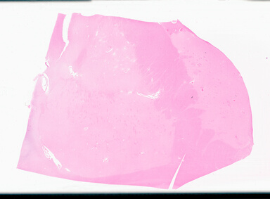 ['deident_6b76b420-2c66-4298-a3a3-4b2fdd6d32af_69d94fba.jpg']