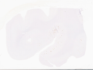 ['deident_e5be0463-58e3-426d-a2d5-f1bbc934c183_69d94fff.jpg']