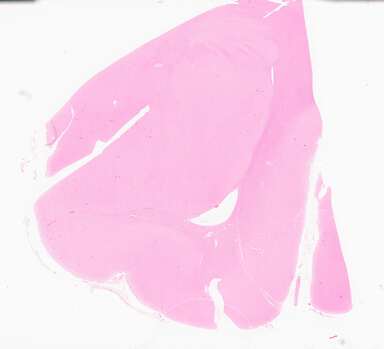 ['deident_2ad4473b-3fb4-4724-aa7b-b9813103bef9_69d94f98.jpg']