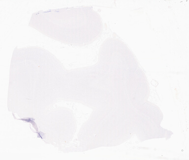 ['deident_d59f5f79-9e48-4c54-b3ad-f8d24ca29209_69d94ff3.jpg']