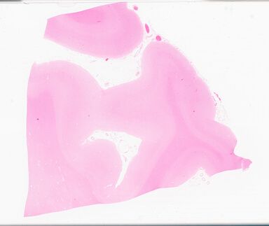 ['deident_4b41183e-2bc1-41c5-81fd-48096f24999e_69d94fa8.jpg']