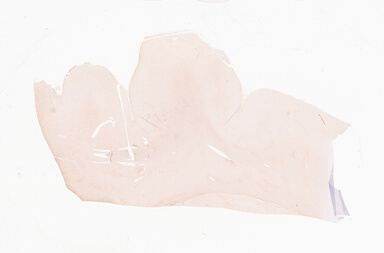 ['deident_08f843d8-73d6-49c2-ae99-9fb067bc3c24_69d94f8d.jpg']