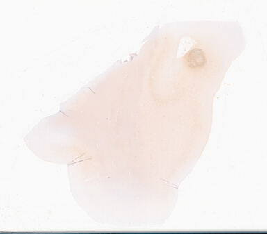 ['deident_7d1872e6-c848-4bd6-892b-2743d9e00ce3_69d94fc8.jpg']