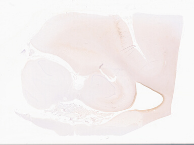 ['deident_25a24831-3618-4916-8f57-cc06100be5d5_69d94f96.jpg']