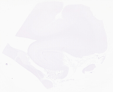['deident_b3b4bbe6-3fea-4c68-b338-8a062a9e79d9_69d94fe2.jpg']