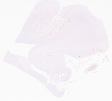 ['deident_f17b798f-f7cf-4bc9-864b-5aa536195b4a_69d95005.jpg']