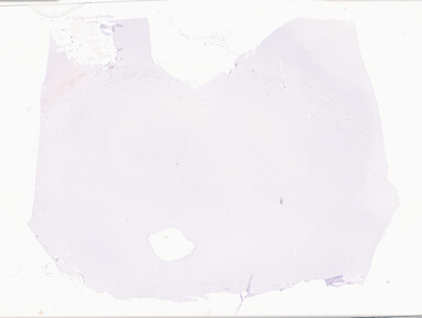 ['deident_36fc01fc-2f93-4894-9bca-a37227297a1b_69d94f9e.jpg']