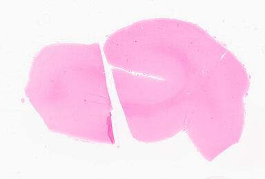 ['deident_690c0949-ff84-4742-9f67-59c6d9053f0a_69d94fb6.jpg']