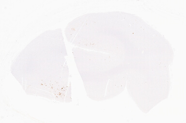 ['deident_abd27f74-7f4a-4cc8-82d5-5125fdefb5aa_69d94fdc.jpg']
