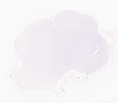 ['deident_184eef94-0e99-4481-9375-9025f9dcc083_69d94f92.jpg']