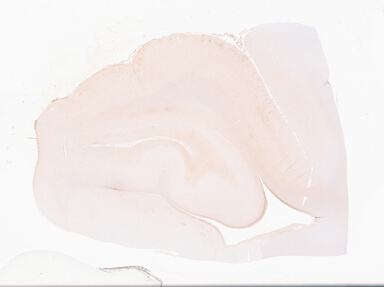 ['deident_d19edfa6-a200-4968-a45a-b364b7d84433_69d94fee.jpg']