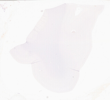 ['deident_49e7c363-485d-403a-989d-24eb3b1fa649_69d94fa5.jpg']