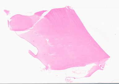 ['deident_f2282727-00bd-4912-b595-94882e9139ec_69d95007.jpg']