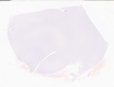 ['deident_c6fb8dd4-91ae-4611-8337-920b25787f46_69d94fe9.jpg']